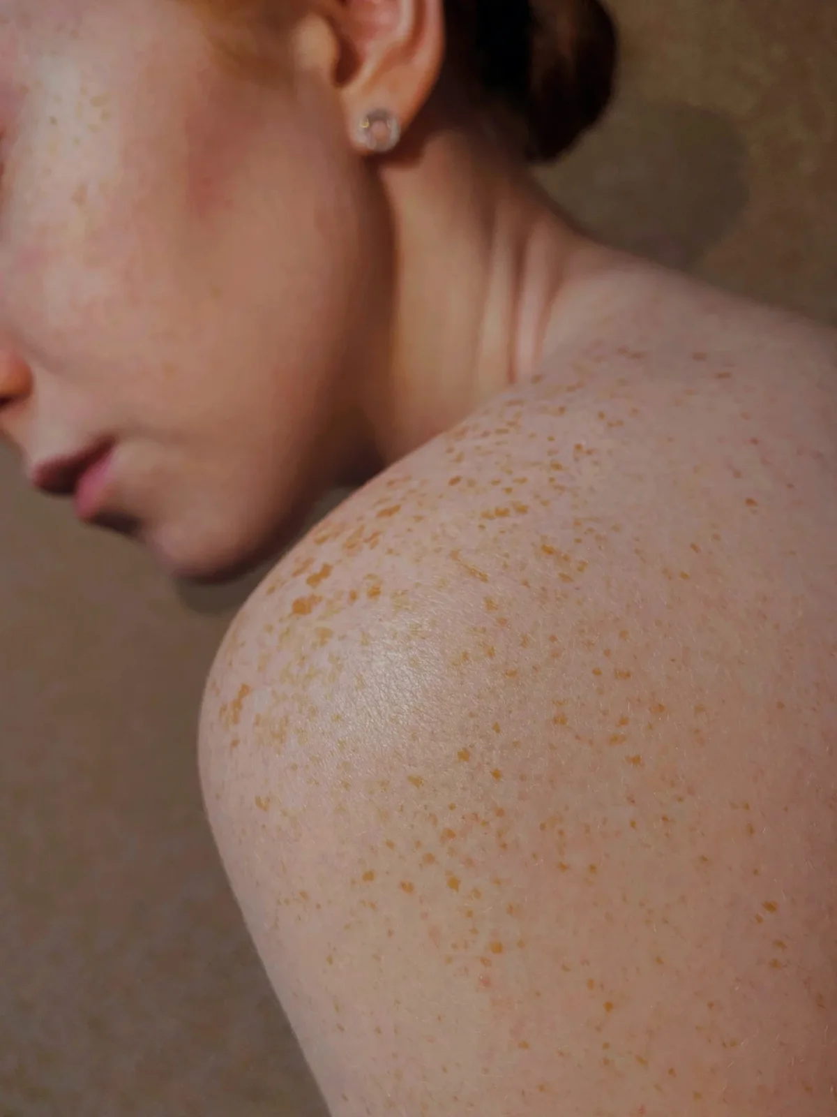 Portrait rapproché : peau, taches de rousseur et lumière naturelle.